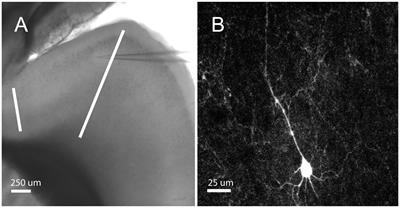 Activity-dependent ectopic action potentials in regular-spiking neurons of the neocortex